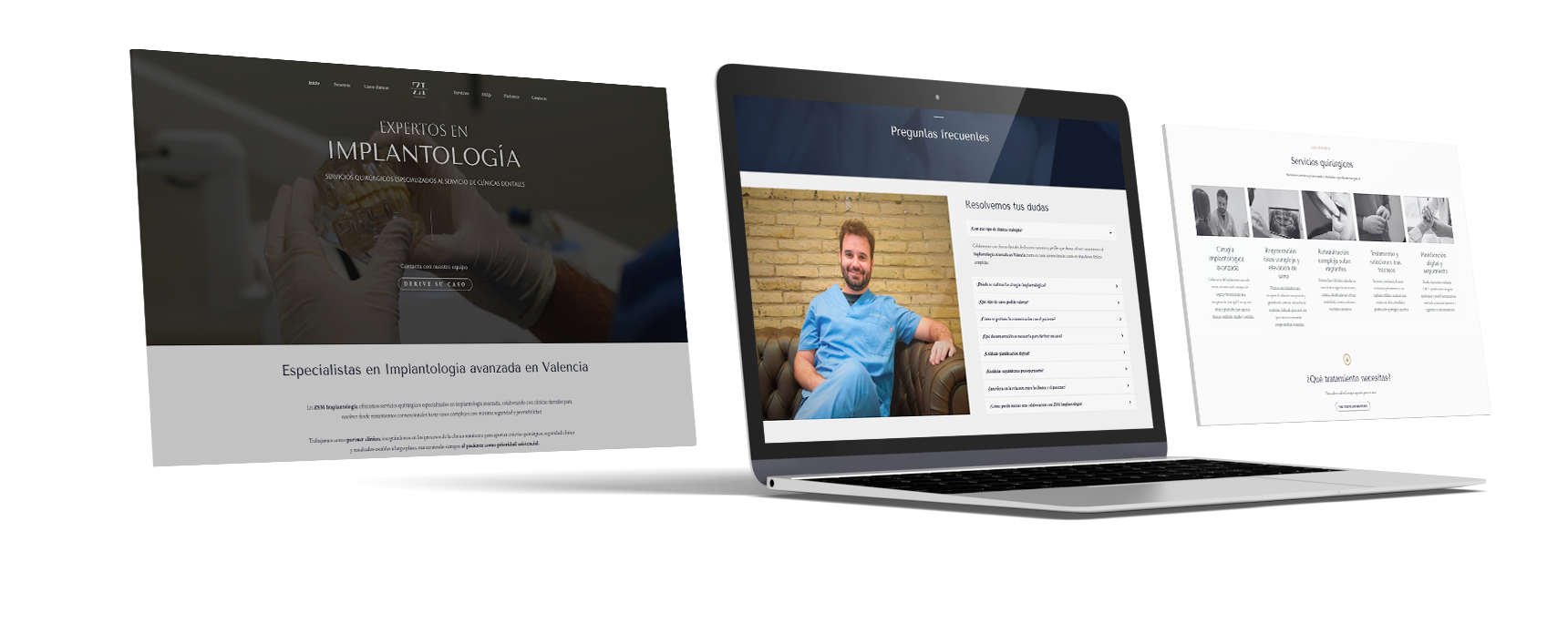 Mockup-Web-secciones-zsm-implantologia